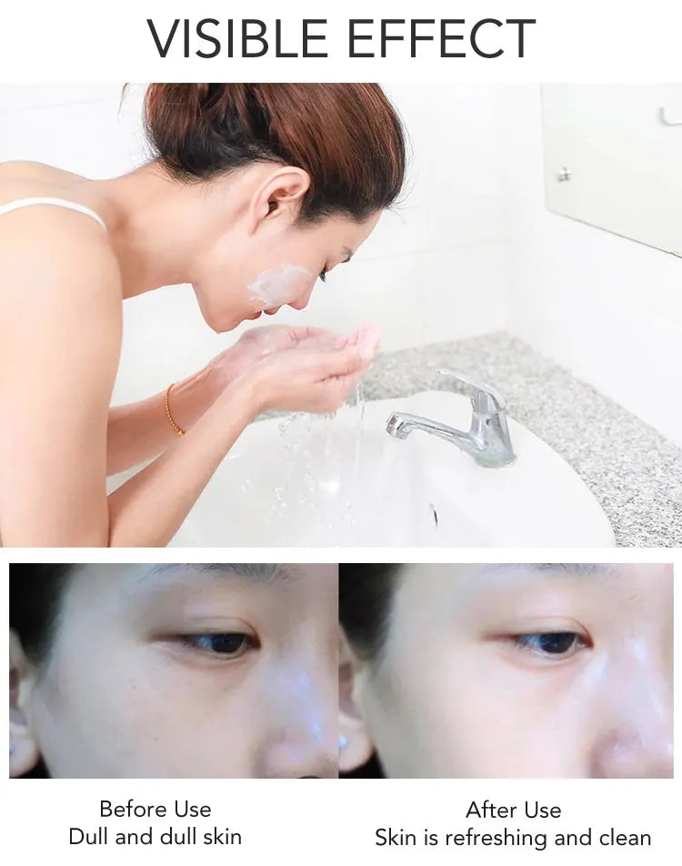 PureGlow Renewal Set - Glow Up Spot Pro