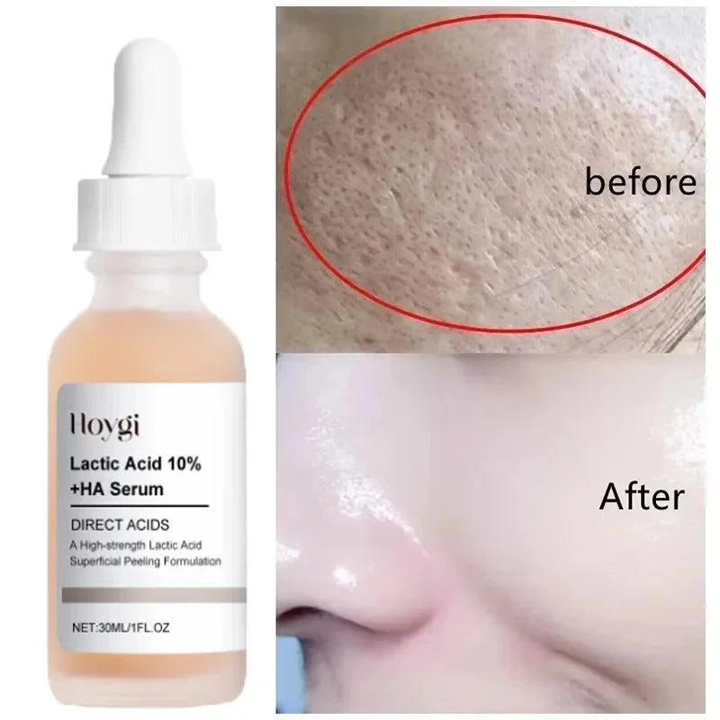 GlowTight Lactic Essence - Glow Up Spot Pro
