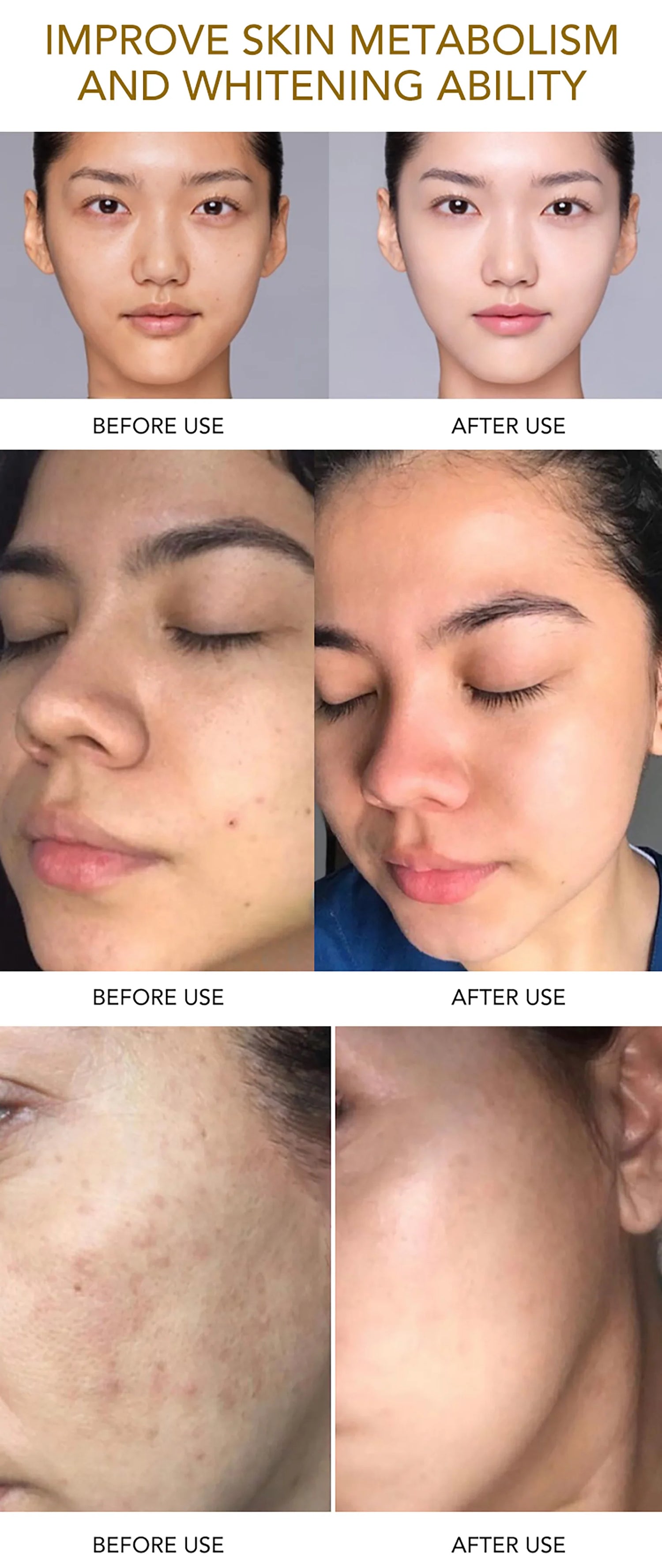 PureGlow Renewal Set - Glow Up Spot Pro