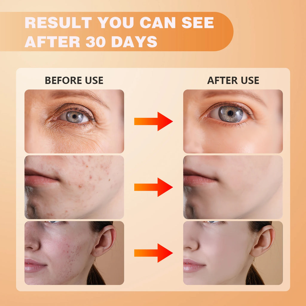 Jitesy LED Beauty Mask