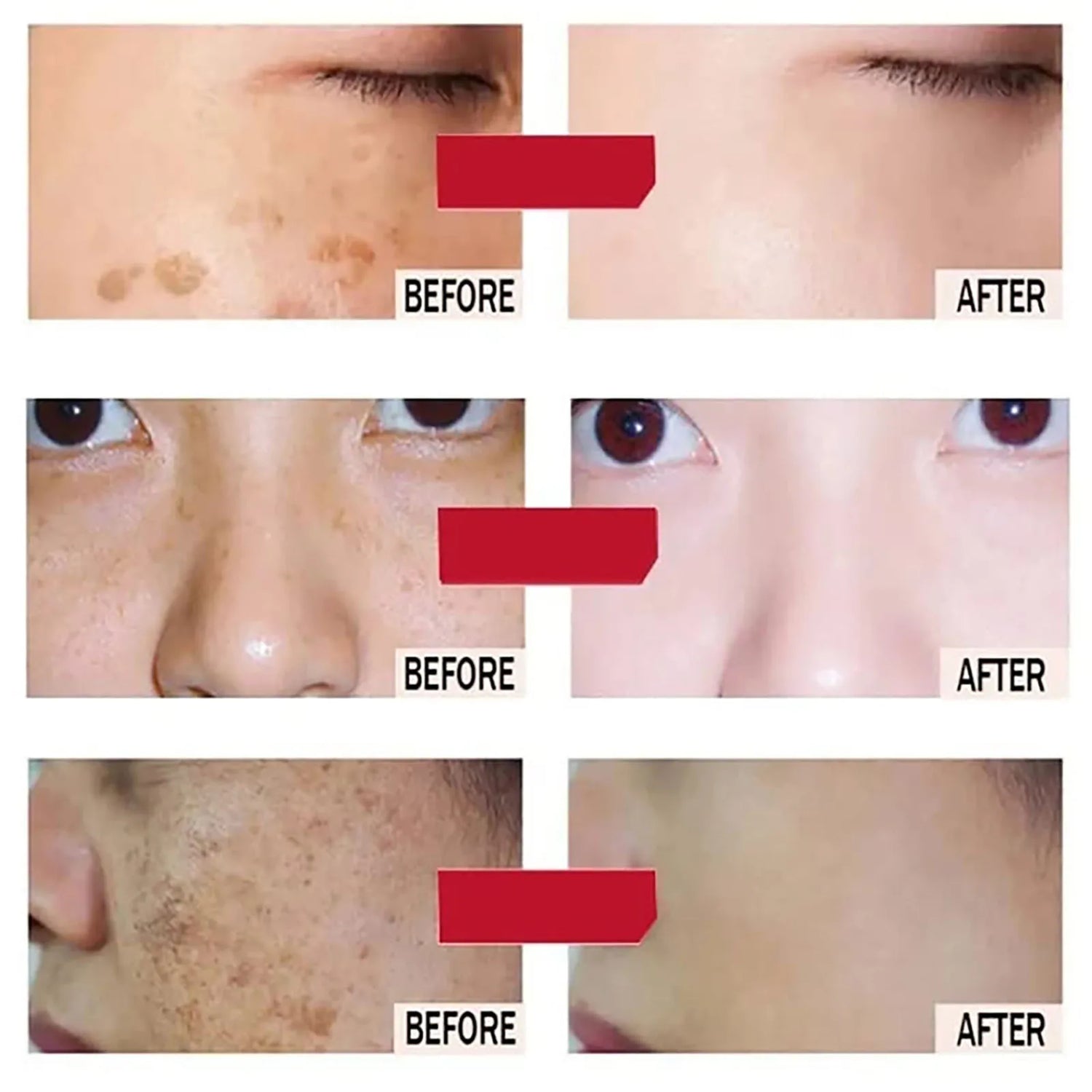 PureGlow Renewal Set - Glow Up Spot Pro